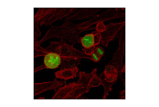  Image 12: Phospho-Histone H3 (Mitotic Marker) Antibody Sampler Kit