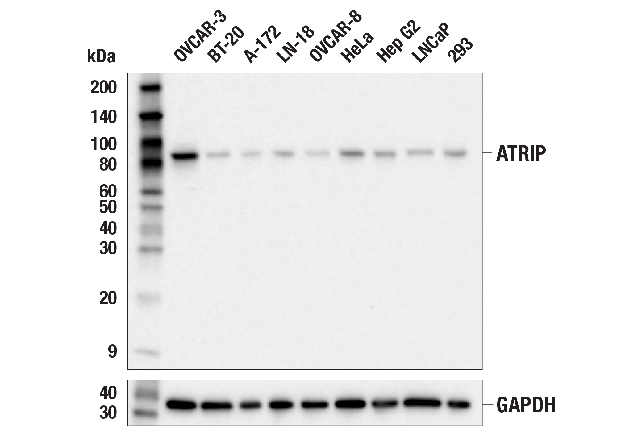 Western Blotting Image 1: ATRIP (E2I9A) Rabbit mAb