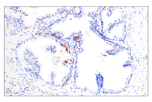  Image 38: Human Reactive M1 vs M2 Macrophage IHC Antibody Sampler Kit