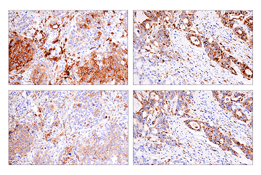  Image 67: Human Reactive M1 vs M2 Macrophage IHC Antibody Sampler Kit