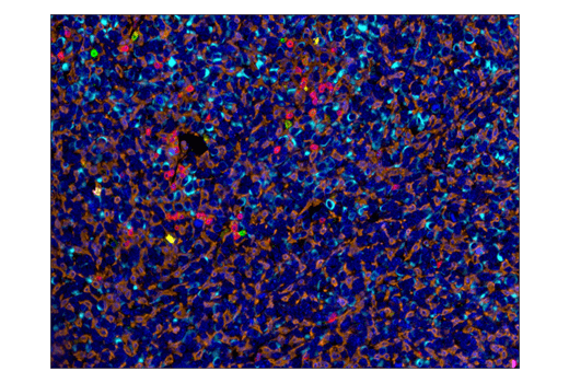 Immunohistochemistry Image 4: CD8α (D4W2Z) XP® Rabbit mAb