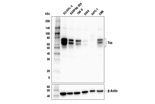 Western Blotting Image 1: Tox Antibody