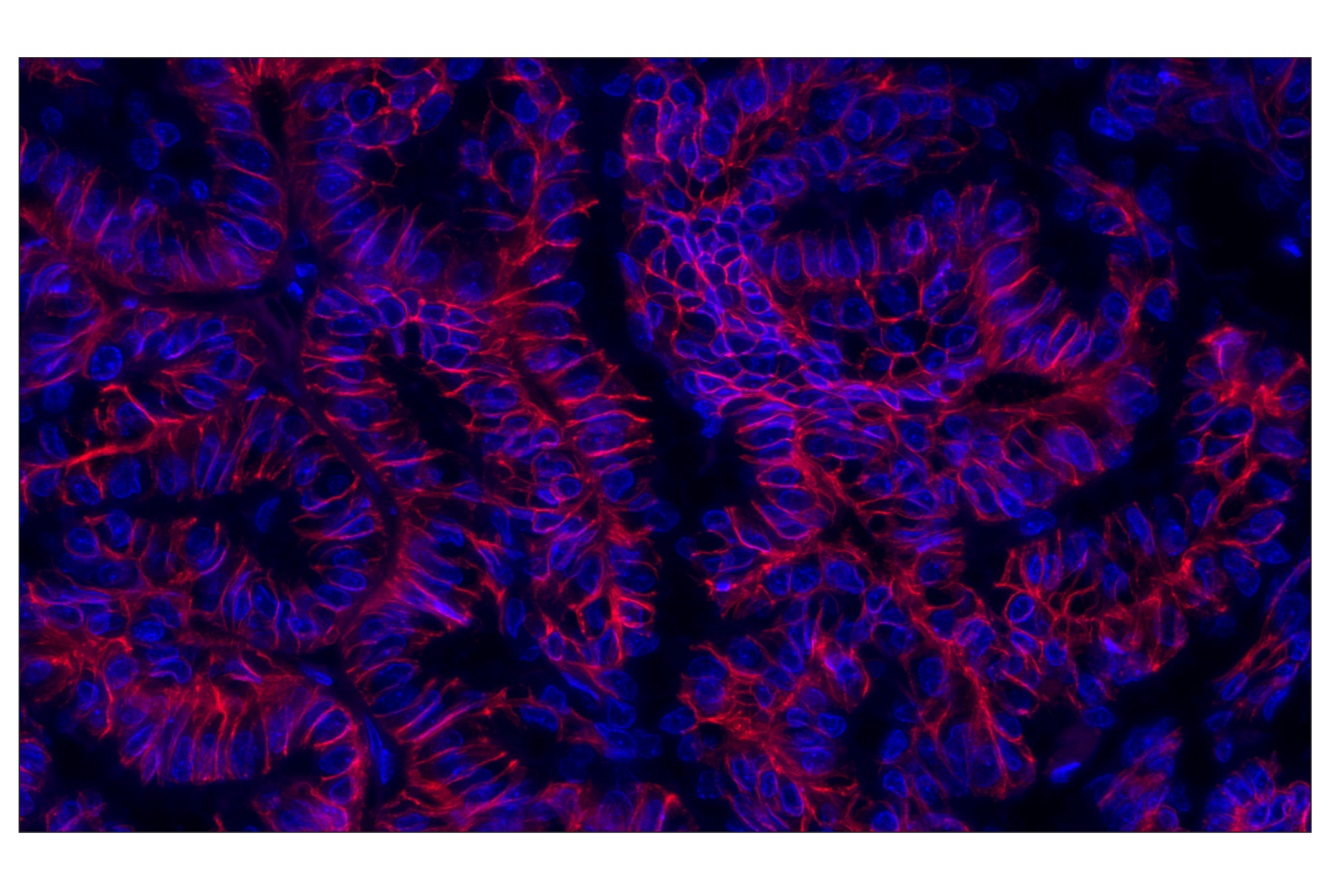 Immunohistochemistry Image 1: NCAM1 (CD56) (E7X9M) XP® Rabbit mAb (Alexa Fluor® 555 Conjugate)