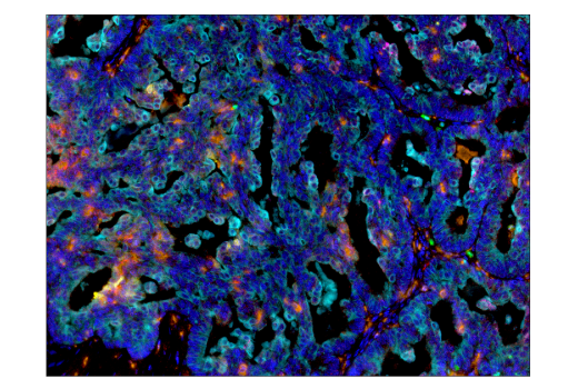 Immunohistochemistry Image 5: PD-L2 (D7U8C™) XP® Rabbit mAb (BSA and Azide Free)