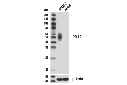 Western Blotting Image 1: PD-L2 (D7U8C™) XP® Rabbit mAb (BSA and Azide Free)