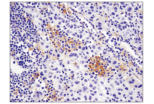 Immunohistochemistry Image 1: PD-L2 (D7U8C™) XP® Rabbit mAb (BSA and Azide Free)