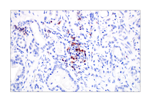  Image 81: Human Exhausted CD8+ T Cell IHC Antibody Sampler Kit