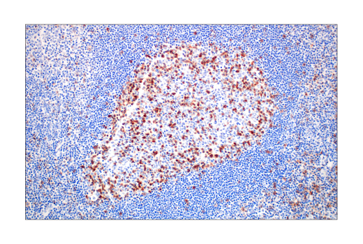 Image 84: Human Exhausted CD8+ T Cell IHC Antibody Sampler Kit