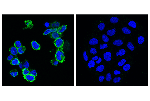  Image 77: Human Exhausted T Cell Antibody Sampler Kit