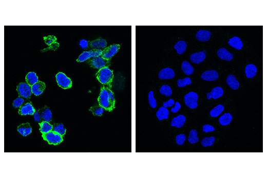  Image 89: Human Exhausted CD8+ T Cell IHC Antibody Sampler Kit