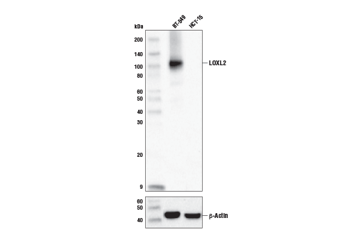 Western Blotting Image 1: LOXL2 (E3P7Y) Rabbit mAb