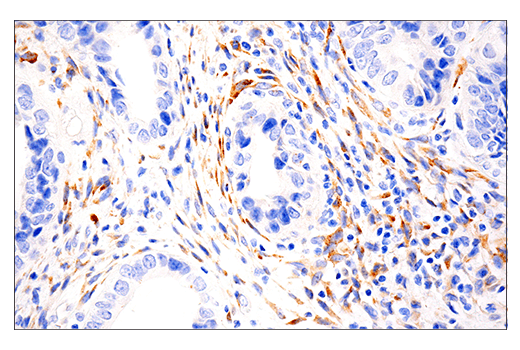 Immunohistochemistry Image 2: LOXL2 (E3P7Y) Rabbit mAb