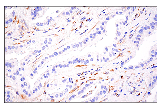 Immunohistochemistry Image 3: LOXL2 (E3P7Y) Rabbit mAb