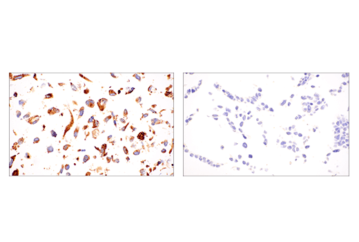 Immunohistochemistry Image 4: LOXL2 (E3P7Y) Rabbit mAb