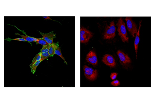  Image 79: Human Immune Cell Phenotyping IHC Antibody Sampler Kit