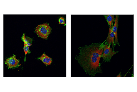  Image 80: Human Immune Cell Phenotyping IHC Antibody Sampler Kit
