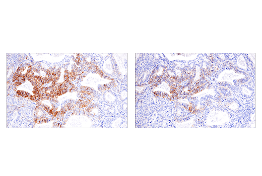 Immunohistochemistry Image 10: NCAM1 (CD56) (E7X9M) XP® Rabbit mAb