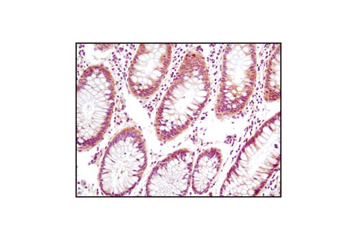 Immunohistochemistry Image 5: PTEN (D4.3) XP® Rabbit mAb (BSA and Azide Free)