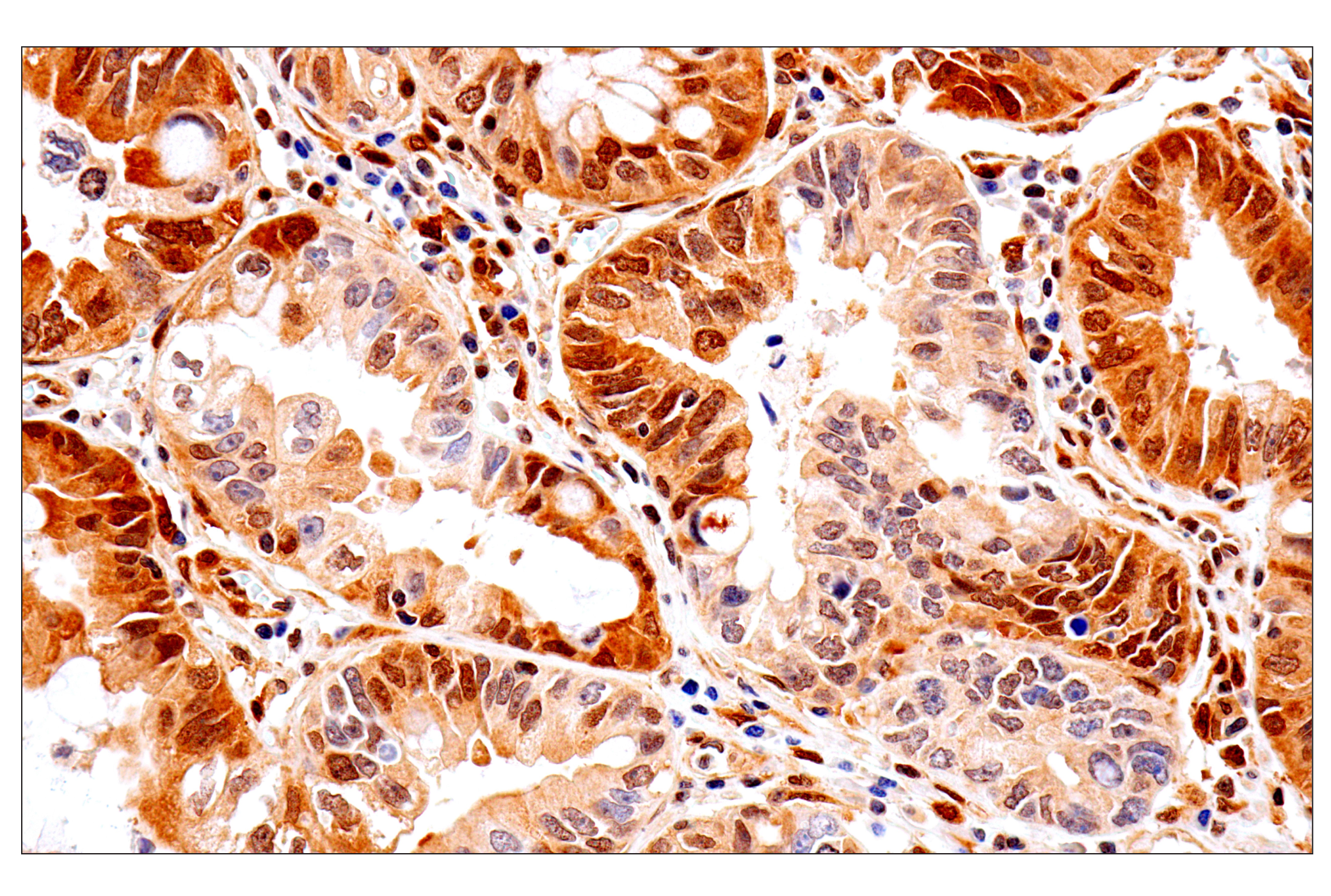 Immunohistochemistry Image 4: PTEN (D4.3) XP® Rabbit mAb (BSA and Azide Free)