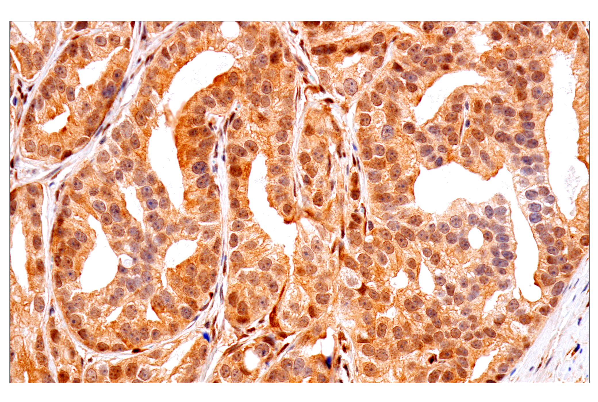 Immunohistochemistry Image 6: PTEN (D4.3) XP® Rabbit mAb (BSA and Azide Free)