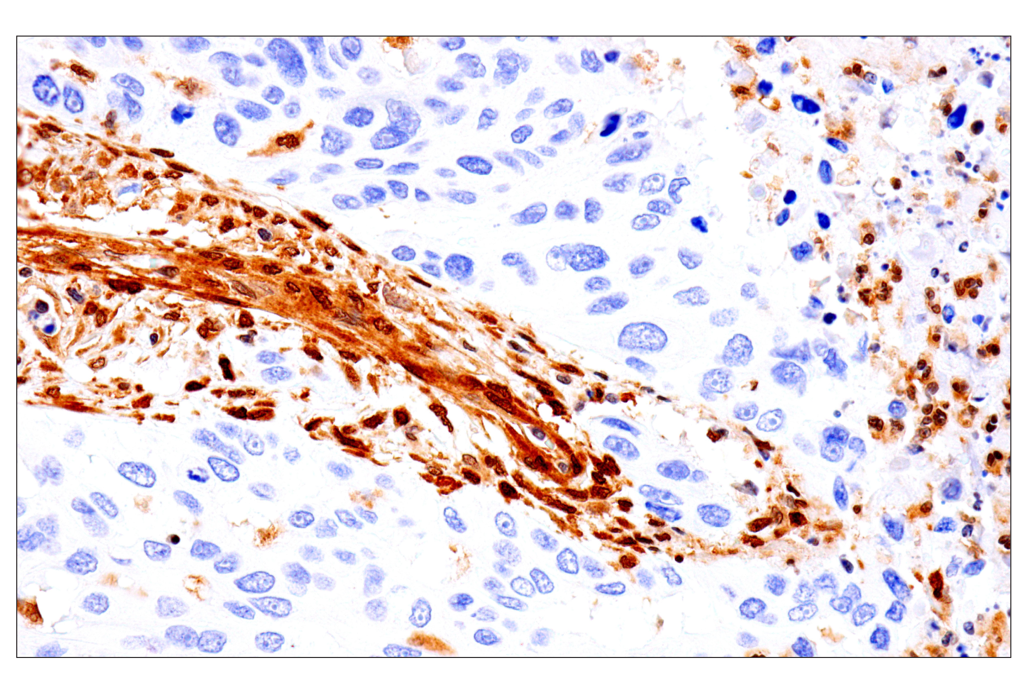 Immunohistochemistry Image 8: PTEN (D4.3) XP® Rabbit mAb (BSA and Azide Free)