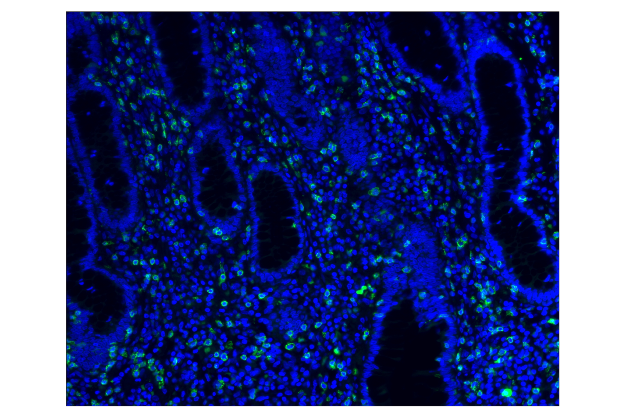 Immunohistochemistry Image 1: CD8α (D8A8Y) Rabbit mAb (Alexa Fluor® 488 Conjugate)